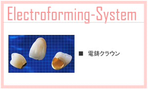 電鋳クラウン