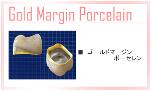 ゴールドマージンポーセレン