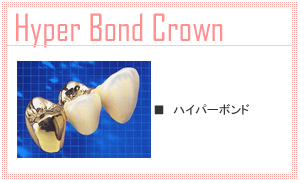 ハイパーボンド