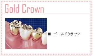 ゴールドクラウン