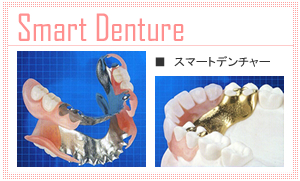 スマートデンチャー