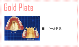 ゴールドプレート