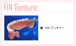 フィンデンチャー