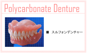 スルフォンデンチャー